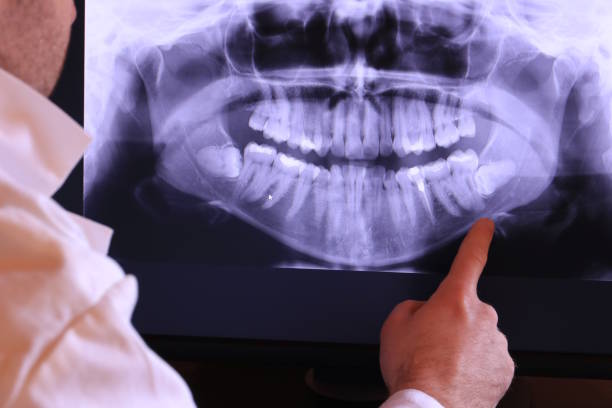 Dentist for Dental Trauma in MS